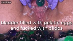 bladder filled with gelatin eggs and fucked with dildos - captioned