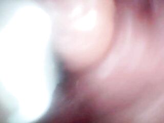 Endoscope camera shows the almost any sensitive parts of the knob Educational episode