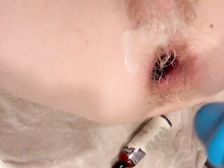 Tiny femboy gapes aperture with massive rod