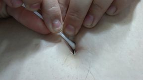 Cleaning hairy navel
