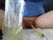 filling the bladder with an inserted catheter CH 28FR