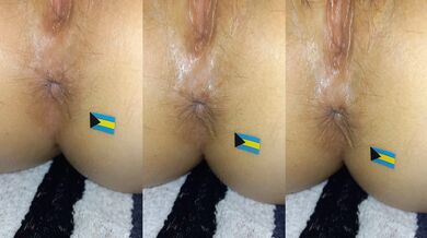anus nassau