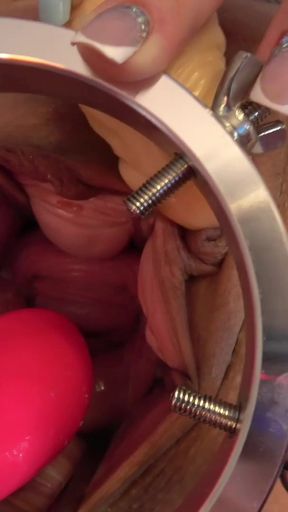 Cervix Vibration Play