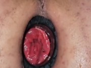 Dilatador anal rosebud