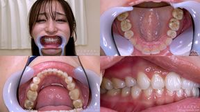 Yuri Adachi - Watching Inside mouth of Japanese cute girl