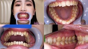 An Komatsu - Watching Inside mouth of Japanese beautiful lady - MOV