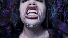 Mouth expander, teeth and lips showing loop HD version