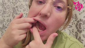 Close Up Mouth Teeth and Tongue Exam