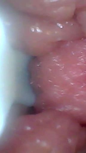 Endoscope Camera Shows the Most Sensitive Parts of the Penis Educational Video