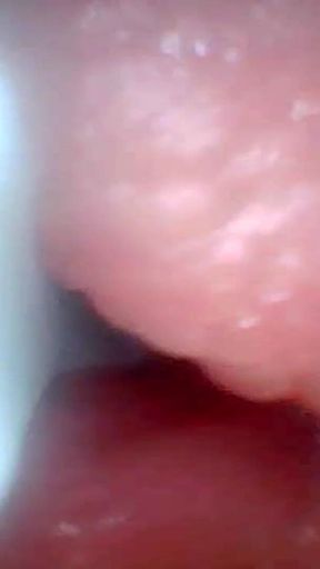Endoscope Camera Shows the Most Sensitive Parts of the Penis Educational Video