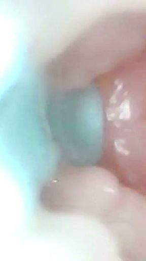 A detailed examination of Lopuza93 oral cavity and anal area using an endoscope camera.   Clip 1