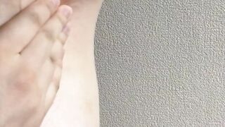 ワキガ手術跡が残る、くさそうな汚い脇。