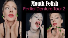 Mouth Fetish: Partial Denture Tour 2 - 720p vertical