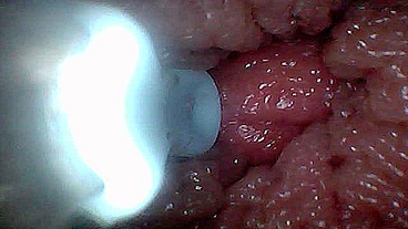 Visual Guide to G-Spot Stimulation and Orgasm — Endoscop Perspective