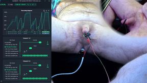FBE Hardstim 020 Another Ride (Different Electrode)