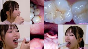Kana Yura - Observing Kana's teeth, mouth, and back of the throat with a dental camera - 1080p
