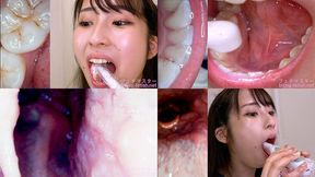 Mino ri Mashiro - Observing Mino ri's teeth, mouth, and back of the throat with a dental camera - 1080p