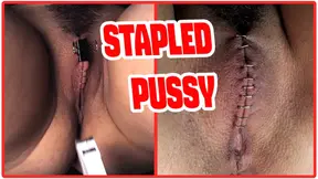 Sadistic Doctor Closes and Staples Submissive Slut's Pussy