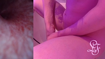 Endoscope POV inflated Bladder - Pissing in the Bathub