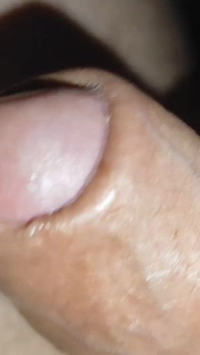 Young Man with Phimosis Opening the Glans