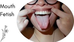 My big mouth