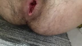 Anal masturbation
