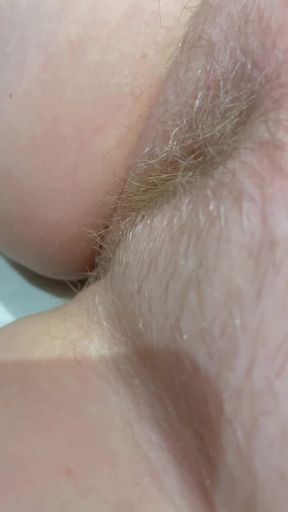 Hairy Labia
