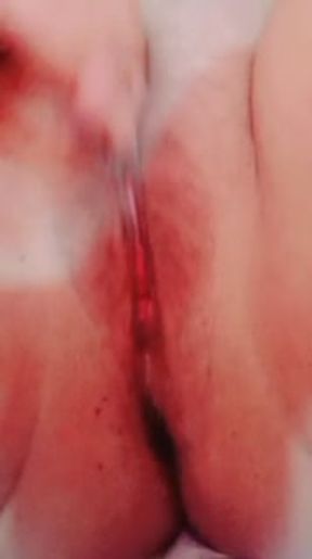 أح طبوني سخون وبغيت ليا يحوني