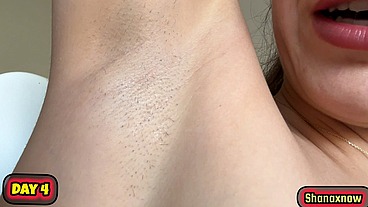 10 DAYS ARMPITS GROW HAIR EVOLUTION VIDEO