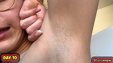 10 DAYS ARMPITS GROW HAIR EVOLUTION VIDEO