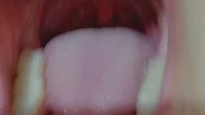 Teeth, tongue, tongue veins, throat, uvula, and to