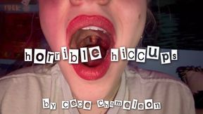 horrible hiccups