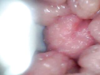 Endoscope camera shows the most sensitive parts of the penis Educational video