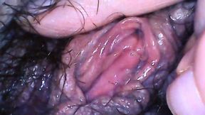 Hairy pussy medical gyno exploration