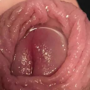 Foreskin close up with alot of piss