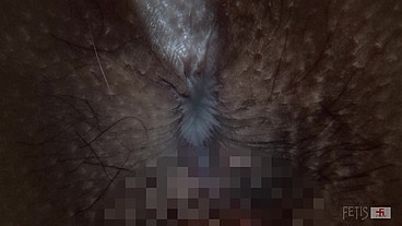Too thick fetish scenes compression. Anus! Uncensored! In close contact! 6 person pack(mix-44/FETIS.JP)