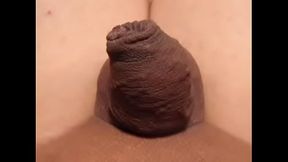 my foreskin