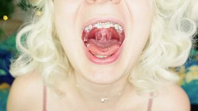 cute asmr video great sound of eating with braces 4k (arya grander)