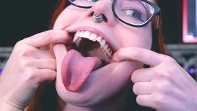 Mouth Tour with New Gold Crown