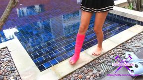 Accident at the housework - short cast leg at home (SCL) part 2