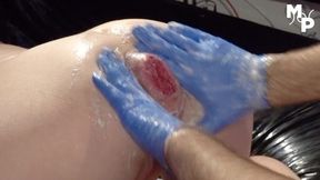 Anal Fisting Toll She Squirts And Pushes Out Her Rosebutt
