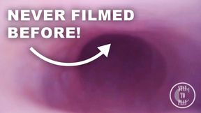 FISRT EVER POV COMSHOT FROM INSIDE THE PROSTATE
