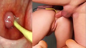 Amazing anal  Camera in Her Ass Deep Anal Fuck and Internal Creampie