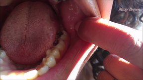 Showing off Summer Mouth and Silver Fillings
