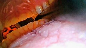 YOU Looking Out! Borescope with Penny!