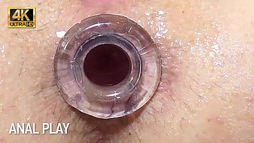Homemade Wife First Anal. Anal Creampie. Enema. Full scene. 31111