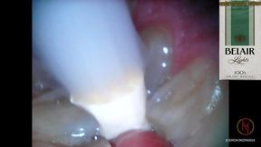 BELAIR 100s lights menthol inside 2