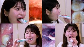 Maina Yuuri - Observing Maina's teeth, mouth, and back of the throat with a dental camera - 1080p