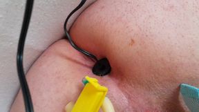 Electro and catheters