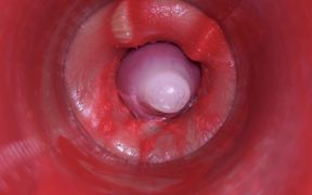 Camera Inside Pussy: Powerfull Cum in Pussy! Best Internal Asmr in 4K More Sperm